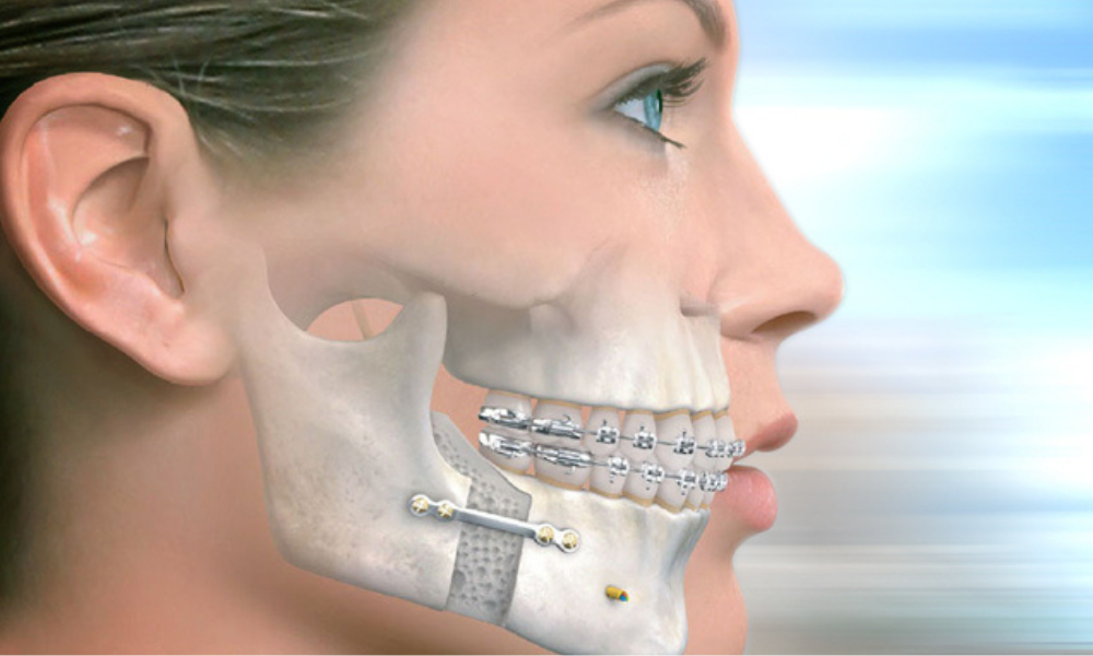 Ağız, Diş ve Çene Cerrahisi